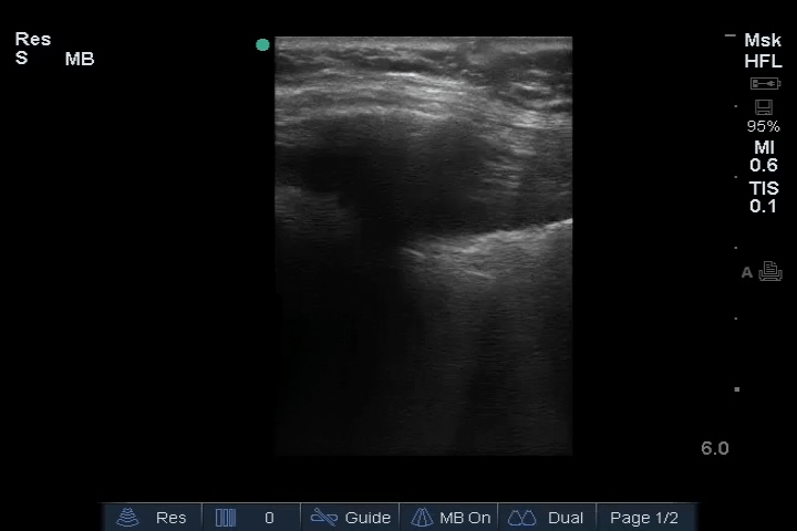 EEU case image missing