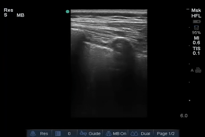 EEU case image missing