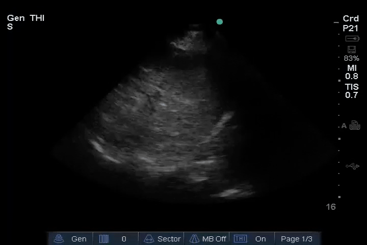 EEU case image missing