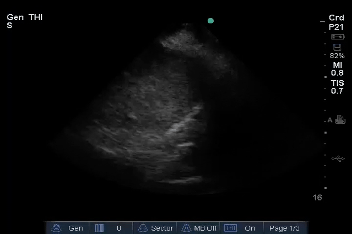 EEU case image missing