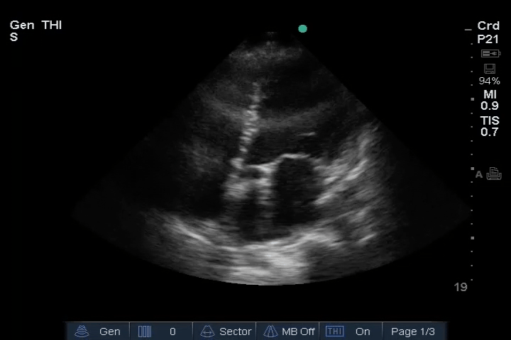 EEU case image missing