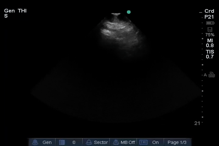 EEU case image missing