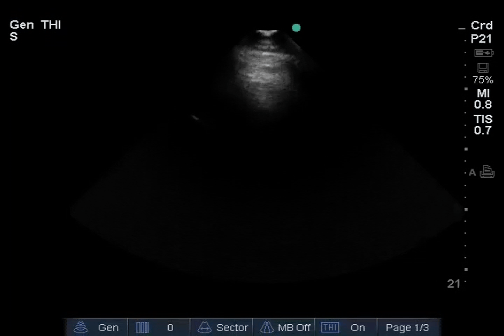 EEU case image missing