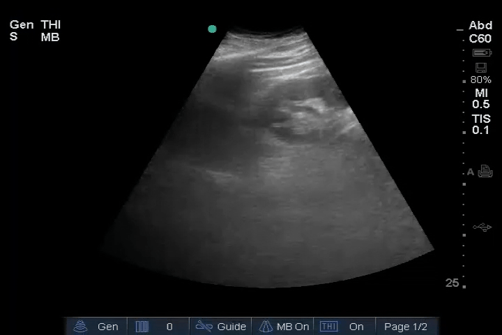 EEU case image missing
