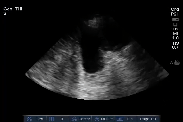 EEU case image missing