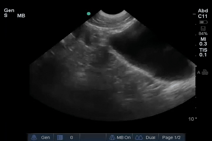 EEU case image missing