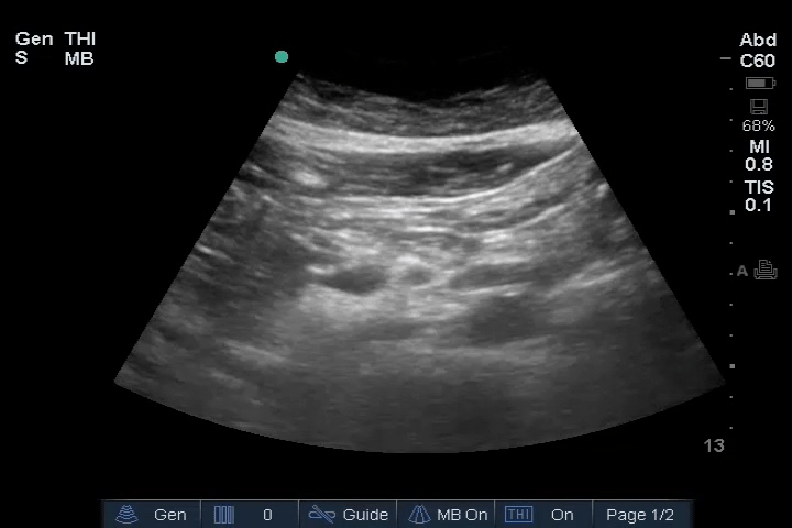 EEU case image missing