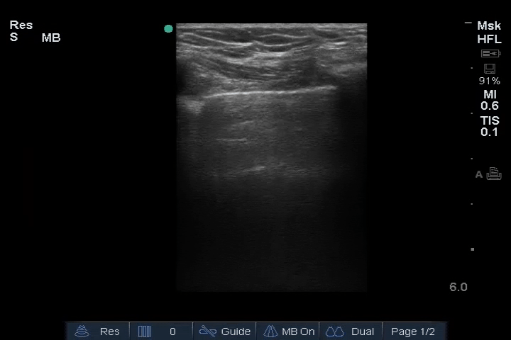 EEU case image missing