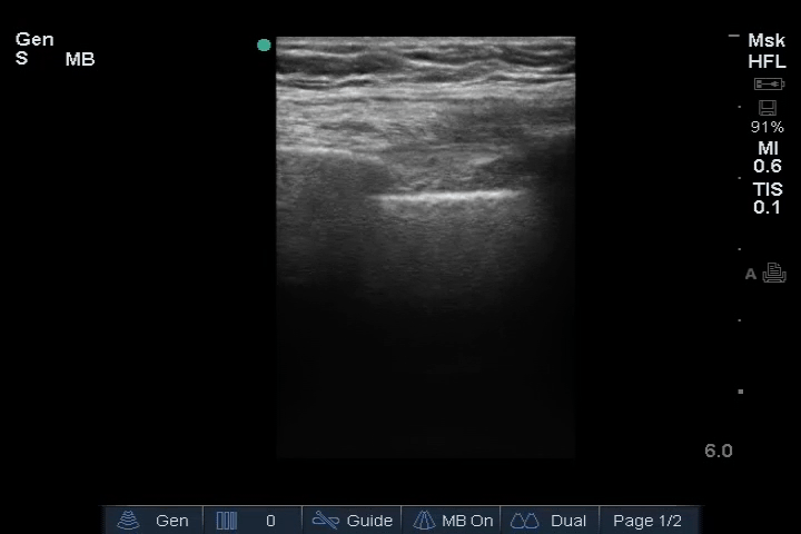 EEU case image missing