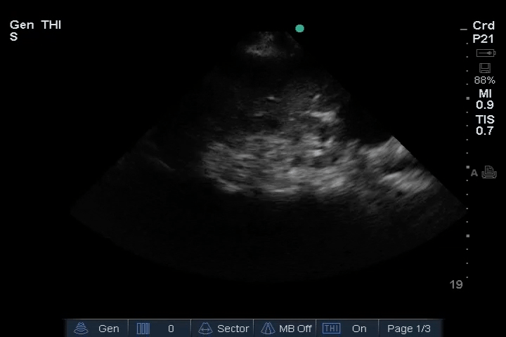 EEU case image missing