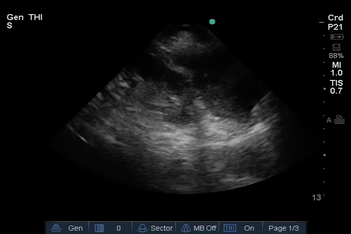 EEU case image missing