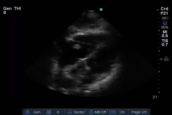 EEU case image missing