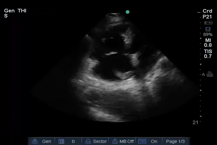 EEU case image missing