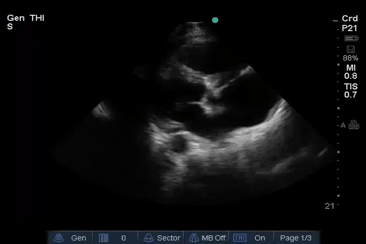 EEU case image missing