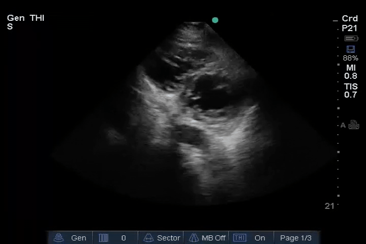 EEU case image missing