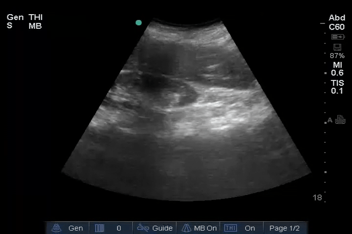 EEU case image missing