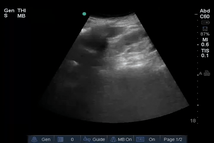 EEU case image missing