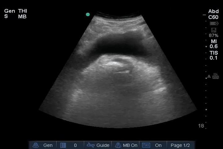 EEU case image missing