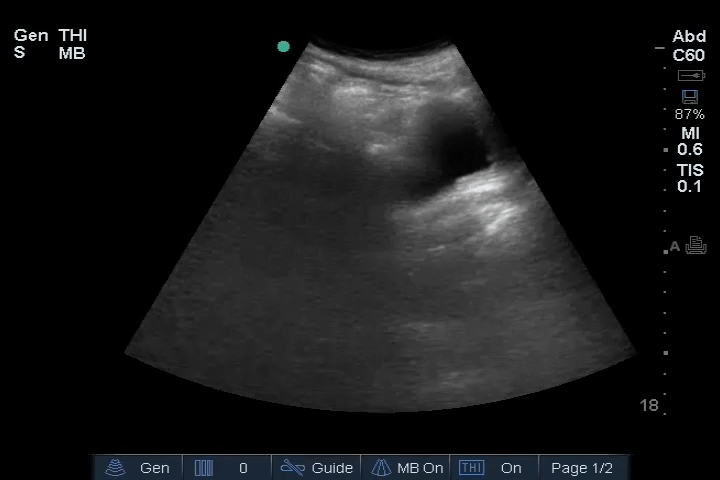 EEU case image missing
