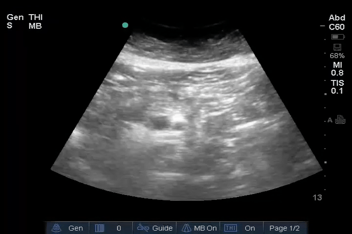 EEU case image missing