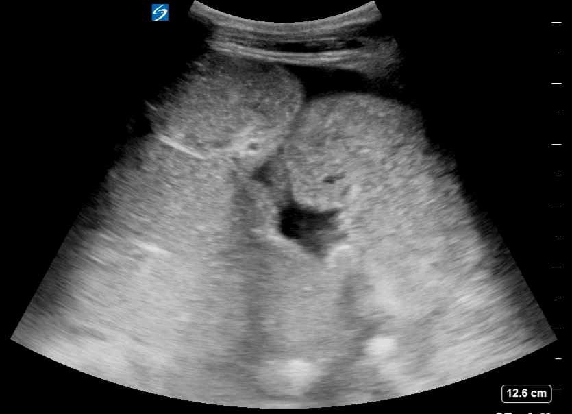 EEU case image missing