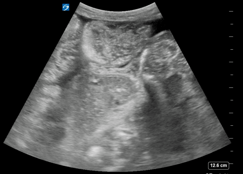 EEU case image missing