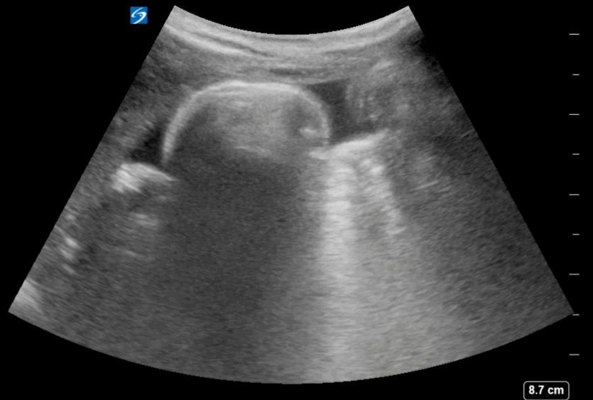 EEU case image missing