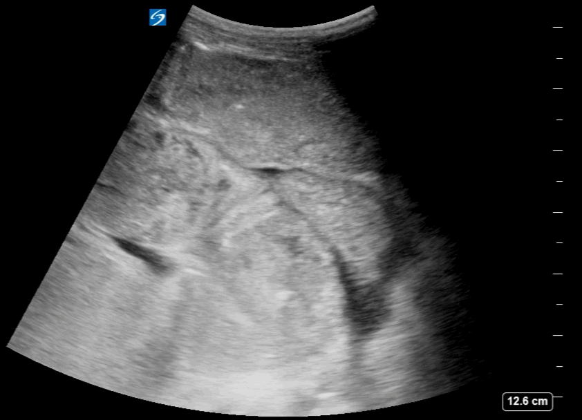 EEU case image missing