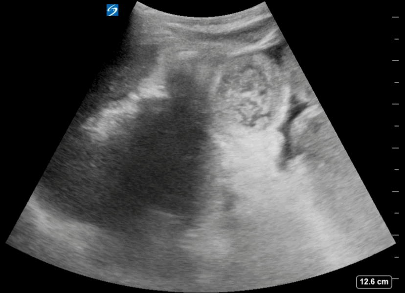 EEU case image missing