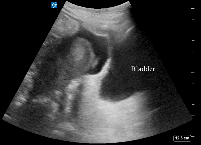 EEU case image missing