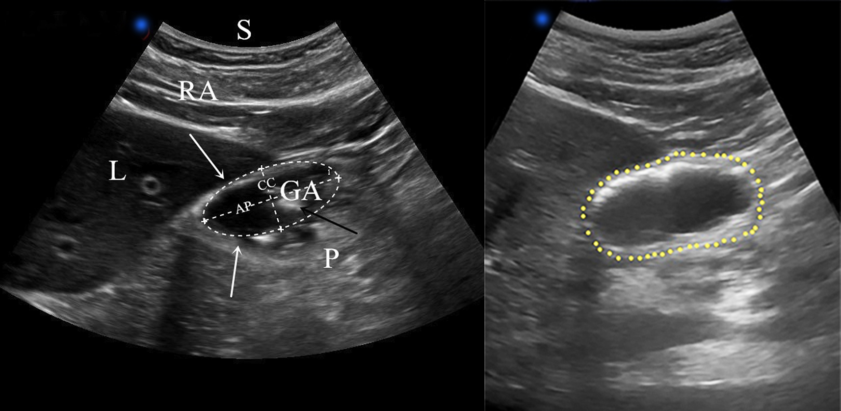 EEU case image missing