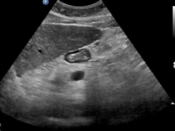 EEU case image missing