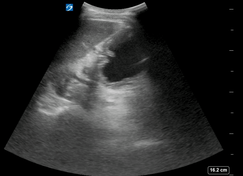 EEU case image missing