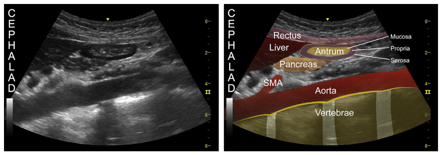 EEU case image missing