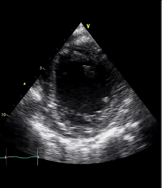 EEU case image missing