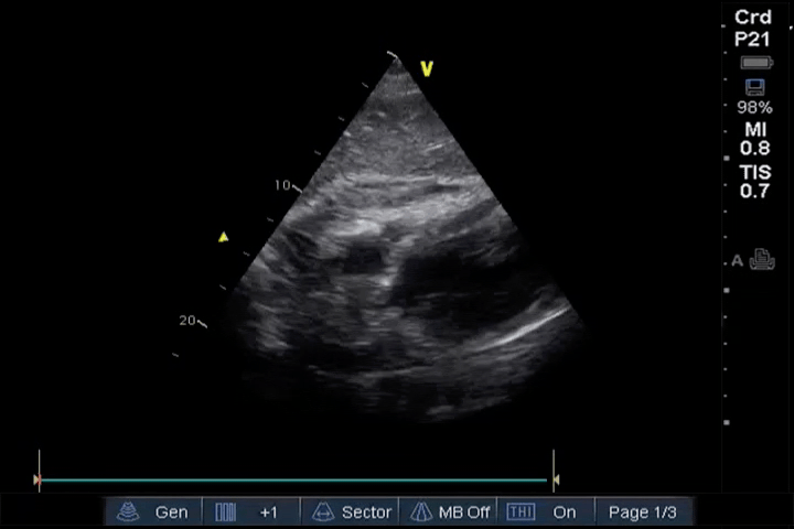 EEU case image missing