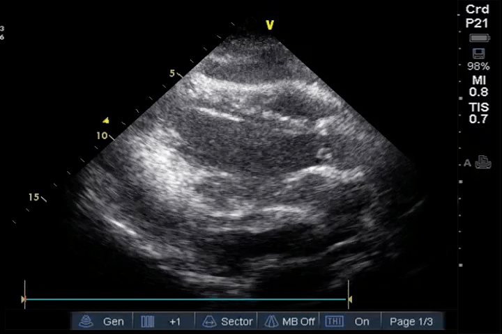 EEU case image missing