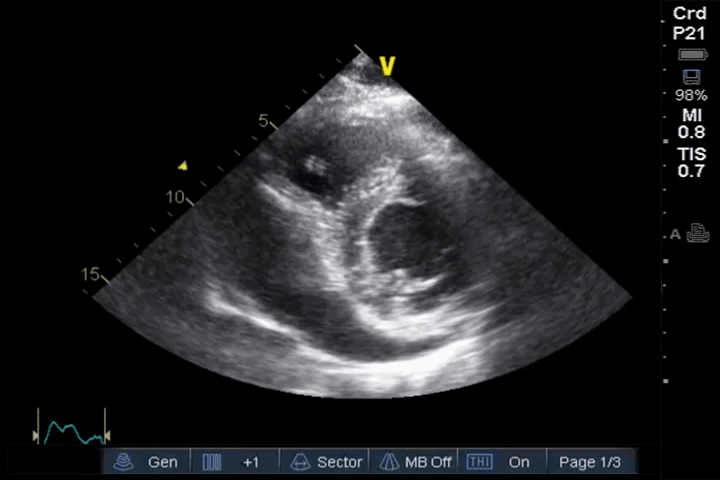 EEU case image missing