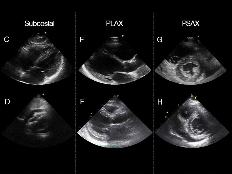 EEU case image missing