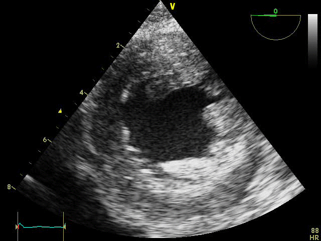 EEU case image missing