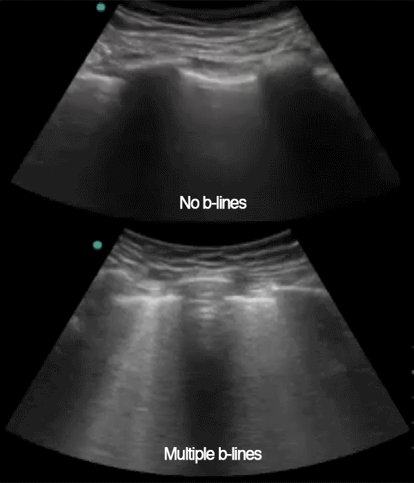 EEU case image missing