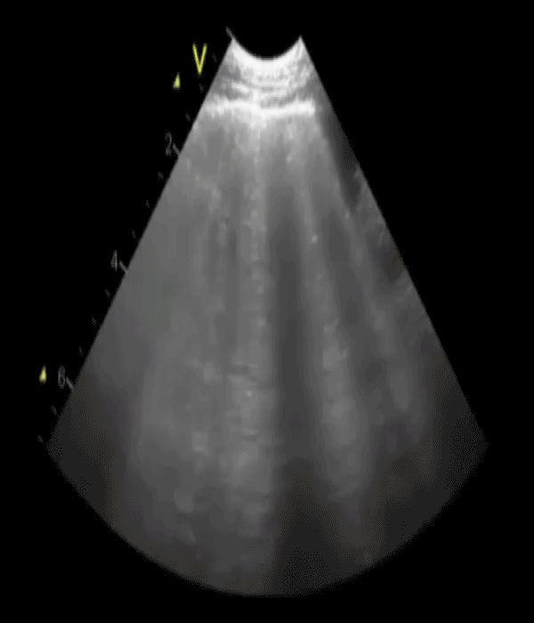 EEU case image missing