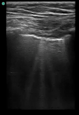 EEU case image missing