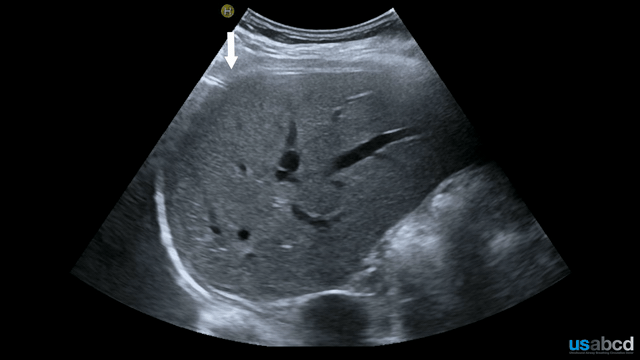 EEU case image missing